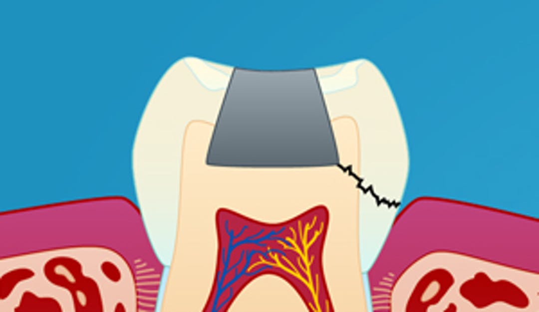 Infraksjoner_w300__f2309d18e0f54be5f96d8c2f1197d26e